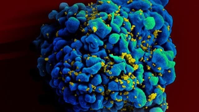 HIV breakthrough: drug trial shows injection twice a year is 100% effective against infection