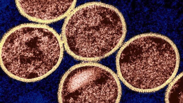 WHO has declared mpox a global health emergency. What happens next?